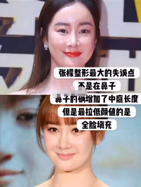 瘦成排骨、動臉成癮、切胃洗腸一起上,女明星的畸形審美太可怕了