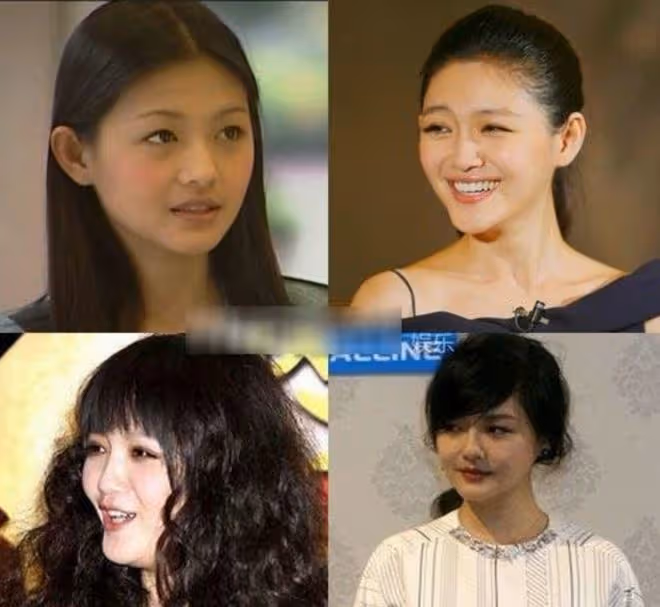 瘦成排骨、動臉成癮、切胃洗腸一起上,女明星的畸形審美太可怕了