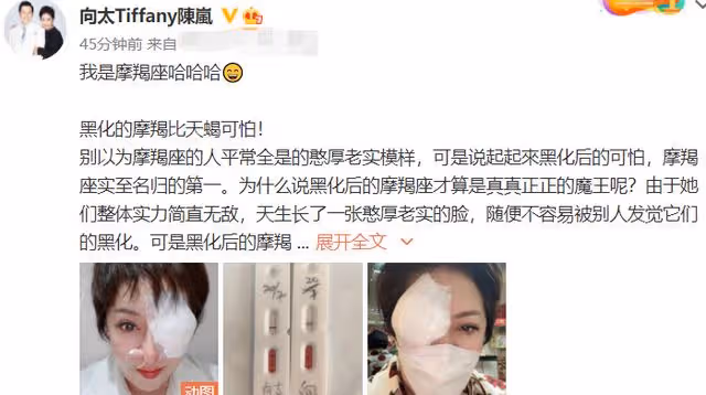 向太雙眼嚴重受傷!厚紗布遮半張臉血絲可怖,否認兒子出軌仍遭罵