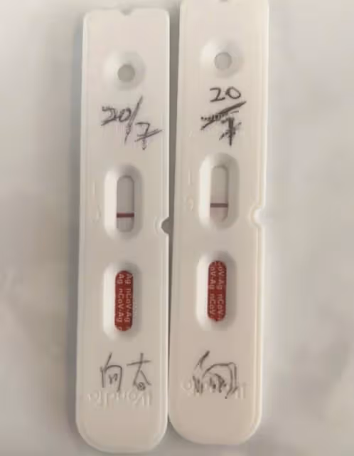 向太雙眼嚴重受傷!厚紗布遮半張臉血絲可怖,否認兒子出軌仍遭罵