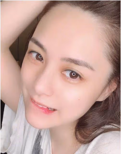 阿嬌真的不會老?連曬18張「近距離自拍」,卻在臉上找不到一絲破綻:宛如18歲少女