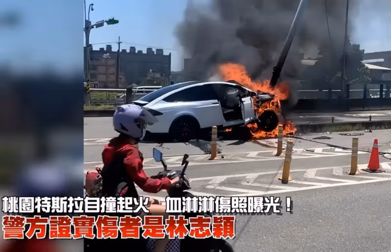 突發!警方確認林志穎開車受傷,小兒子受傷照曝光,父子倆暫無生命危險