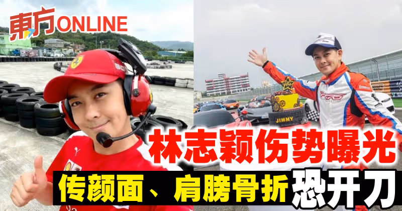 林志穎送醫後傷勢曝光　傳顏面、肩膀骨折恐開刀