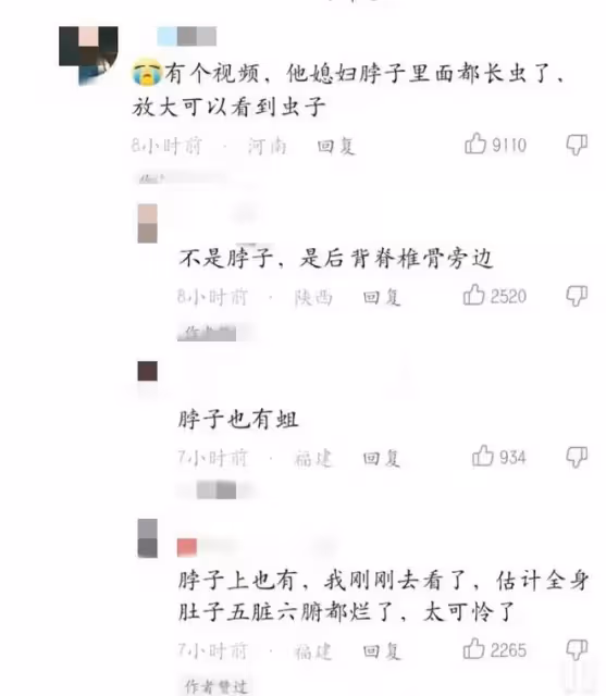 抗癌網紅身上長蛆，疑被丈夫利用撈金，此前已有2位網紅丈夫翻車