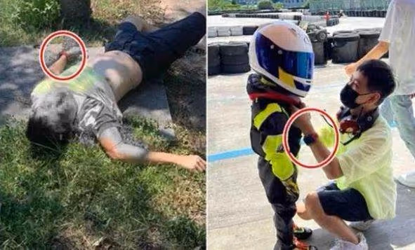 林志穎傷情曝光，人已清醒，但面部還需手術，整形醫生都要參加