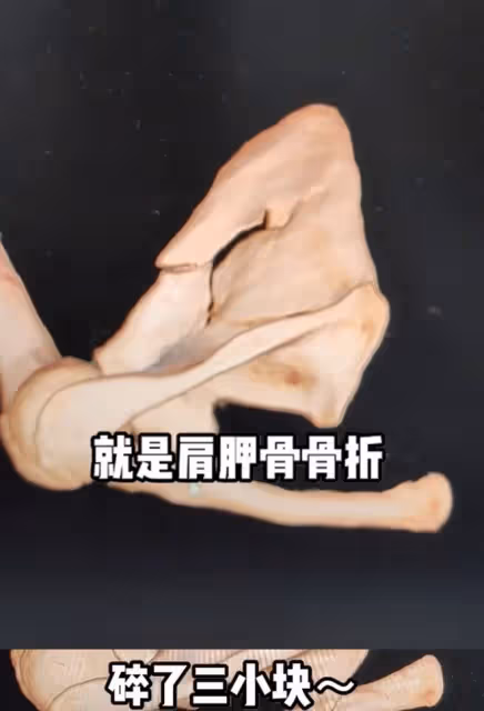 26歲美女網紅鐵豆出車禍!多車連撞當場失去意識,已緊急送醫治療