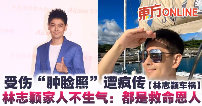 【林志穎車禍】受傷「腫臉照」遭瘋傳　林志穎家人：不會生氣