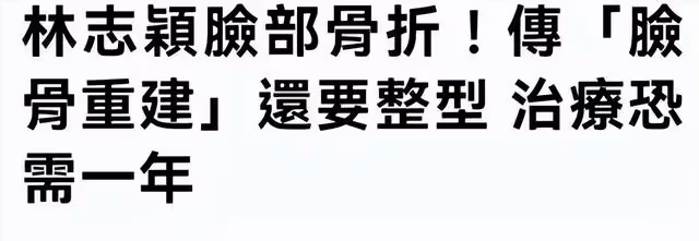 林志穎實慘!面部重建至少一年,本人還未清醒,當地機構就要索賠