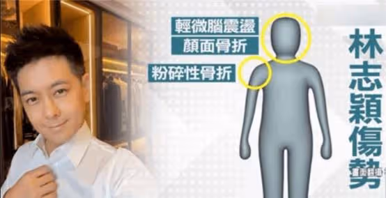 林志穎昏迷三天仍在ICU!被機構要求索賠2萬元,家人懸賞恩人20萬