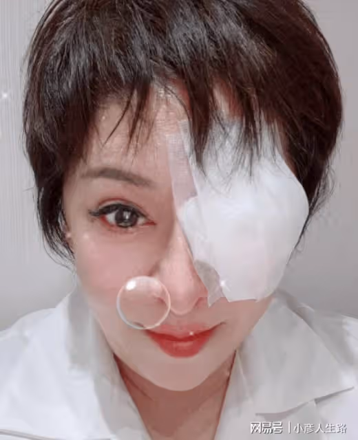 一天之內6個瓜:林志穎車禍臉部骨折,張鐵林剮蹭別車被拍不承認