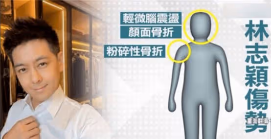林志穎被機構要求索賠賠金 家人懸賞恩人20萬