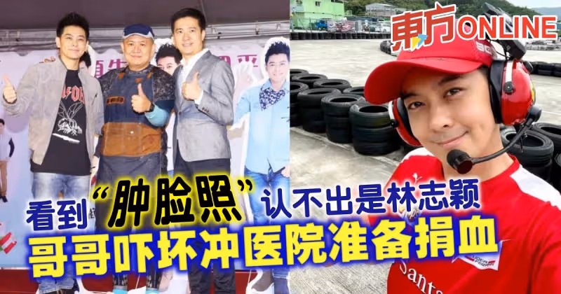 看到「腫臉照」認不出是林志穎　哥哥嚇壞沖醫院準備捐血