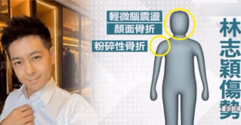 明天和意外誰先來：林志穎車禍如遲延5秒脫困，財產如何分配繼承