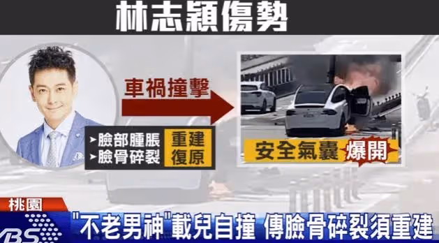 林志穎掙扎數次想起身，市民稱兒子安全才躺下，建模修臉或一年