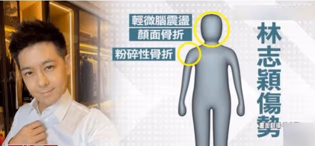 林志穎掙扎數次想起身，市民稱兒子安全才躺下，建模修臉或一年
