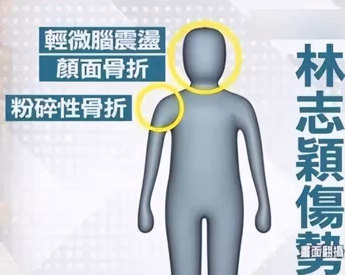 陳若儀發文表示「林志穎清醒了」,家人表示贈予恩人每人100萬