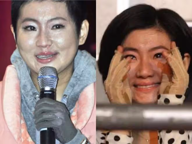 與死神擦肩而過的10位明星，林志穎與死亡差5秒，胡歌臉部縫140針