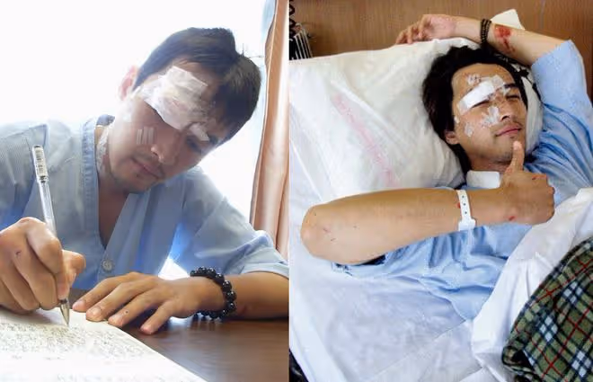 與死神擦肩而過的10位明星，林志穎與死亡差5秒，胡歌臉部縫140針