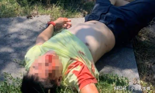 林志穎情況不容樂觀,清醒後仍需進一步觀察