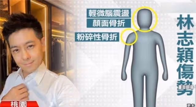 林志穎兒子已出院，陳若儀帶兒子回家，現由70歲母親照看林志穎