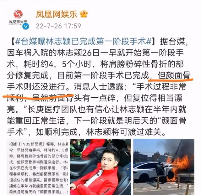 暫不修復面部？林志穎首次手術5小時完成，林心如送祝福