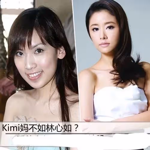暫不修復面部？林志穎首次手術5小時完成，林心如送祝福