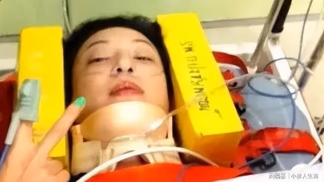 那些死裡逃生的明星,胡歌臉部縫140針,吳京與死神差0.3秒