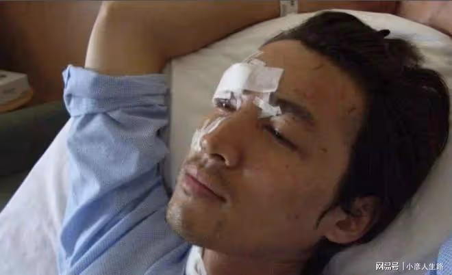 那些死裡逃生的明星,胡歌臉部縫140針,吳京與死神差0.3秒