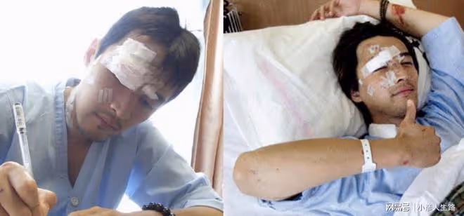 那些死裡逃生的明星,胡歌臉部縫140針,吳京與死神差0.3秒