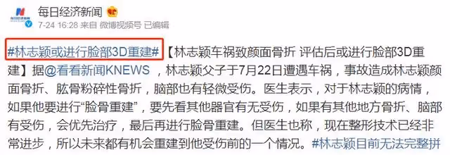 林志穎車禍毀容真相流出,6人被曝:事情沒這麼簡單