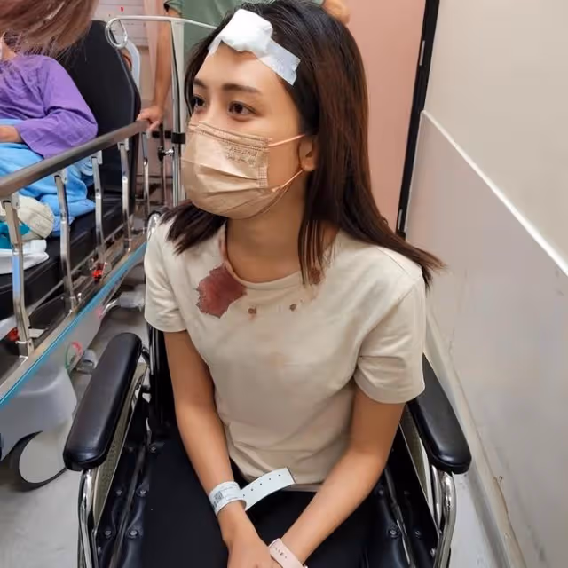 31歲港星被燈砸破頭!血流滿面衣領被染紅,緊急送醫後仍堅持拍戲