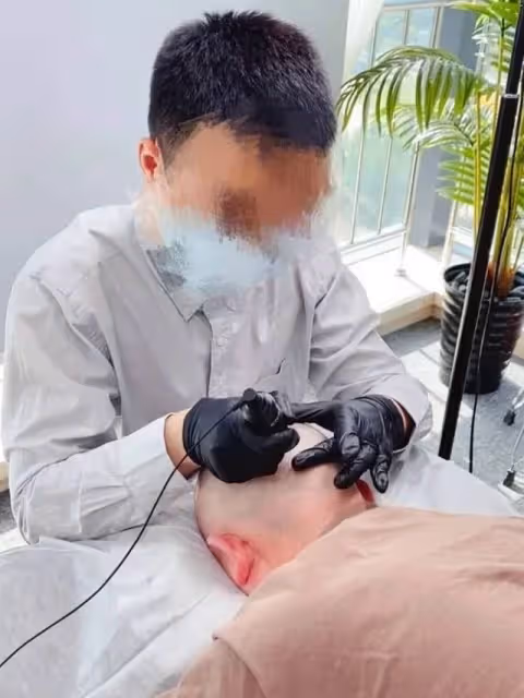 大S老公具俊曄去紋「頭髮」畫面曝光,一針一針紋在頭上,看著就疼