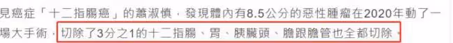 台灣知名女星癌症復發 已轉移到肝臟