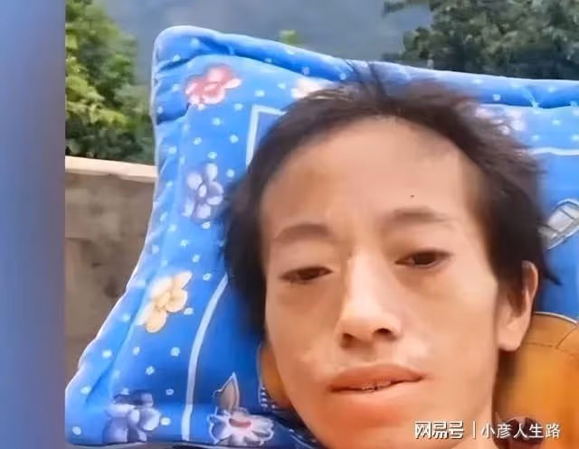 29歲網紅生四胎後患癌,不僅被丈夫利用撈金,身上長蛆還不給治