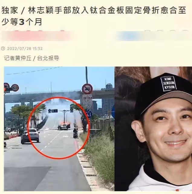 曝林志穎第二場手術完成:手臂放鈦合金固定,需等3個月才能癒合