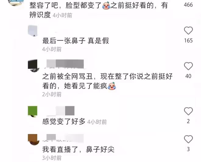 袁姍姍武漢過早被偶遇,大熱天穿毛線背心露肚臍,鼻子怪異疑整容