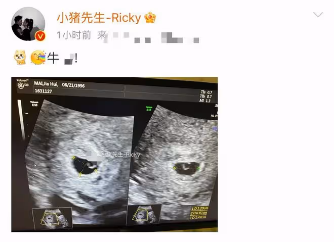 百萬粉網紅官宣二胎!辦婚禮僅1周女兒剛8個月,曾自曝想生兒子