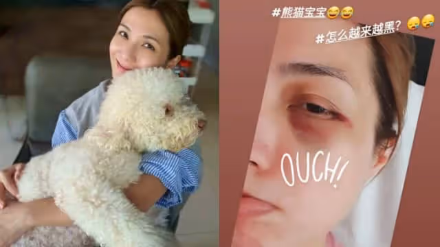 因椎間盤突出導致半身無力　賴怡伶開始注重中醫養生