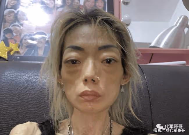 她21歲嫁入豪門:全身癱瘓 闊太夢毀了她的一生