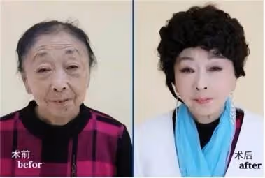 27歲小伙不顧父母反對,執意娶大32歲妻子,20多年過去,如今現狀卻讓人唏噓