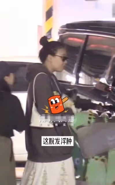 馬思純露面大變樣!脫髮嚴重髮際線逼近頭頂,臉部浮腫狀態堪憂