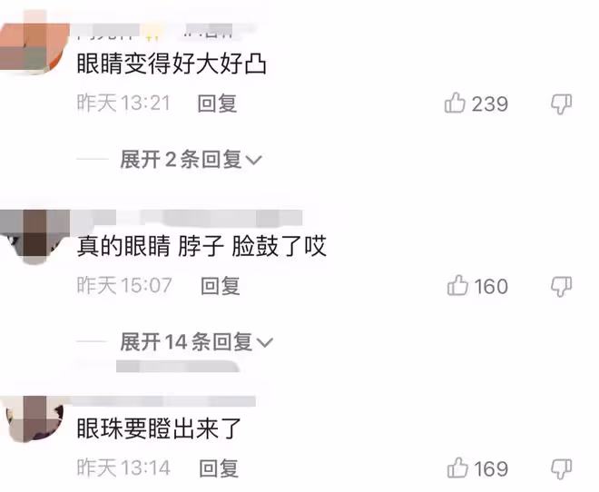 39歲孫儷疑患甲亢,近照眼凸脖子鼓被指太嚇人,養生方式飽受質疑