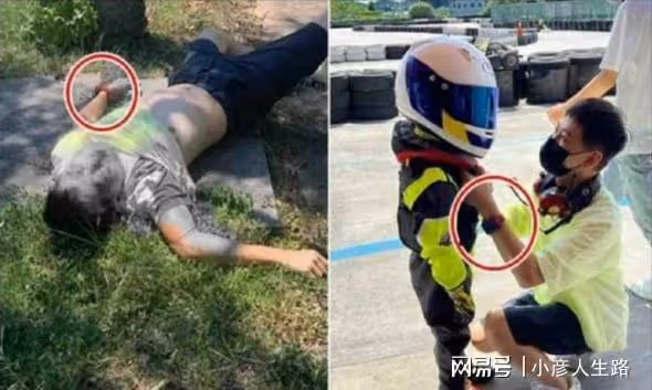林志穎車禍疑與剎車有關？顏面骨折胳膊扭曲，林家人慾給百萬酬謝