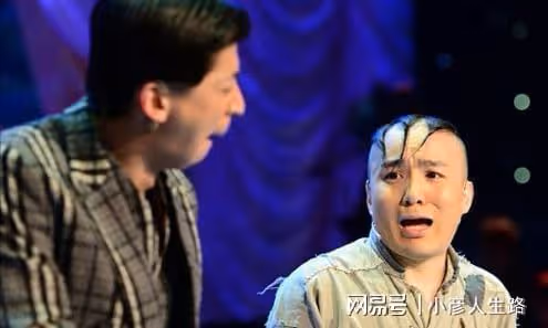 「三毛」孟志超:為演「三毛」意外變禿頂,為植髮挨300多針