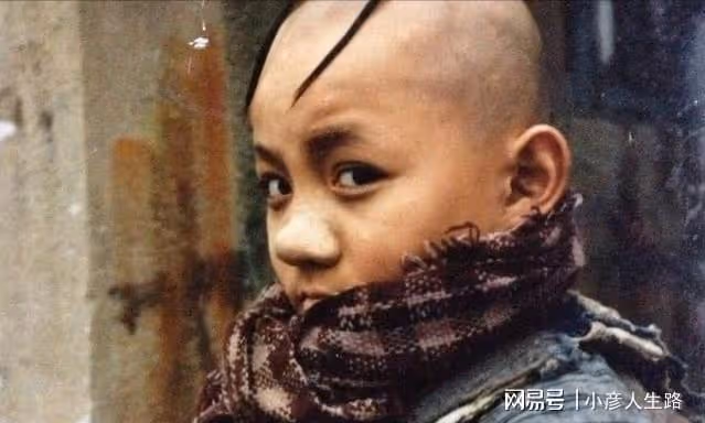 「三毛」孟志超:為演「三毛」意外變禿頂,為植髮挨300多針