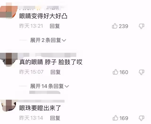 孫儷疑患甲亢 近照臉部變化大被指眼凸脖子鼓