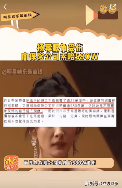 楊冪受傷索賠500多萬?工作室至今不敢發近照