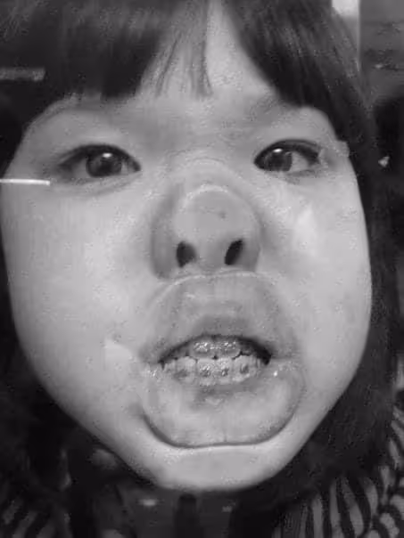 32歲女星承認整容!鼻子變歪一推就動需手術修復,曾經還全身抽脂