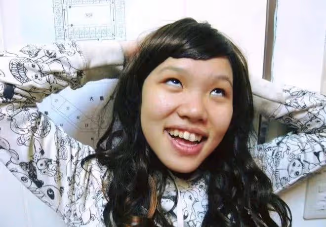 32歲女星承認整容!鼻子變歪一推就動需手術修復,曾經還全身抽脂