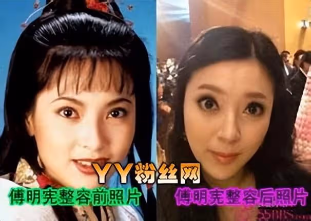 被稱最美郭芙!巔峰隱退「29歲嫁100億富豪」2入豪門遭拋棄 現整容成「網紅臉」令人唏噓